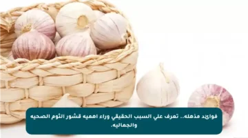 فوائد مذهلة.. تعرف على السبب الحقيقي وراء أهمية قشور الثوم الصحية والجمالية.